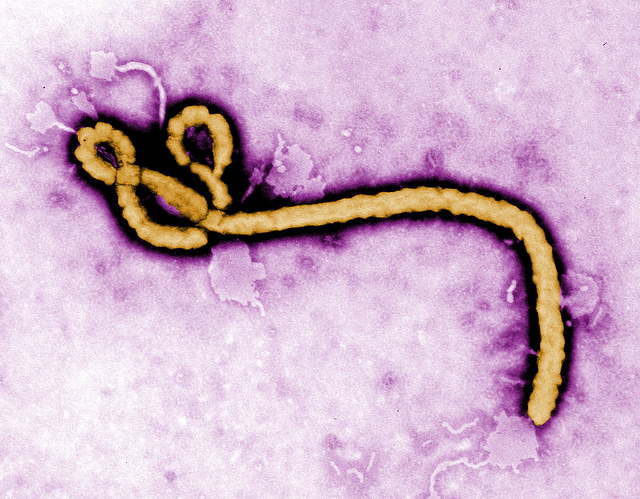 Would Hoosier hospitals be able to handle an Ebola outbreak?